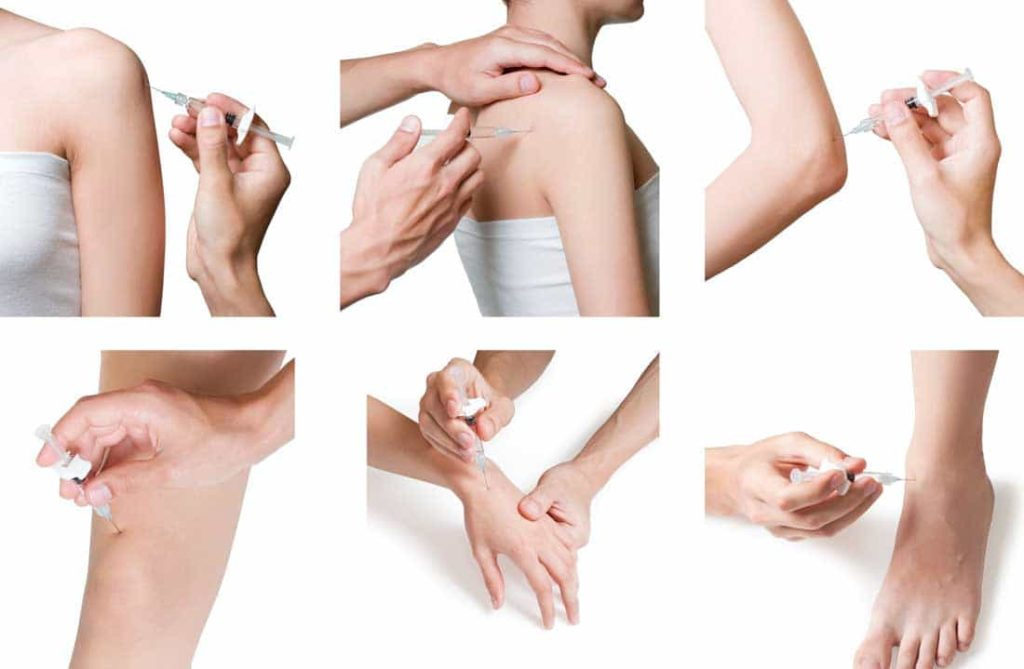 Acupuncture Point Injection Therapy 